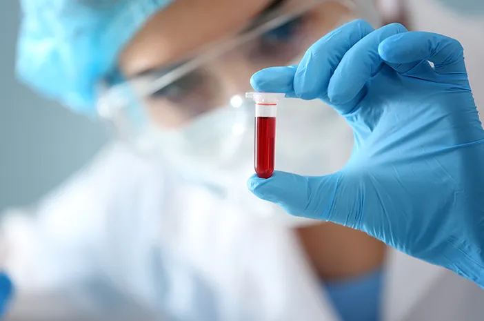 pemeriksaan lab penting